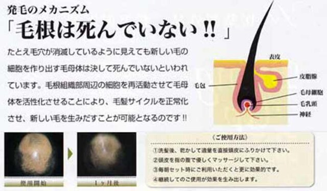 死ぬ 毛根 毛根が死ぬと２度と発毛しない？｜広島で発毛治療・薄毛治療ならDANTEに相談