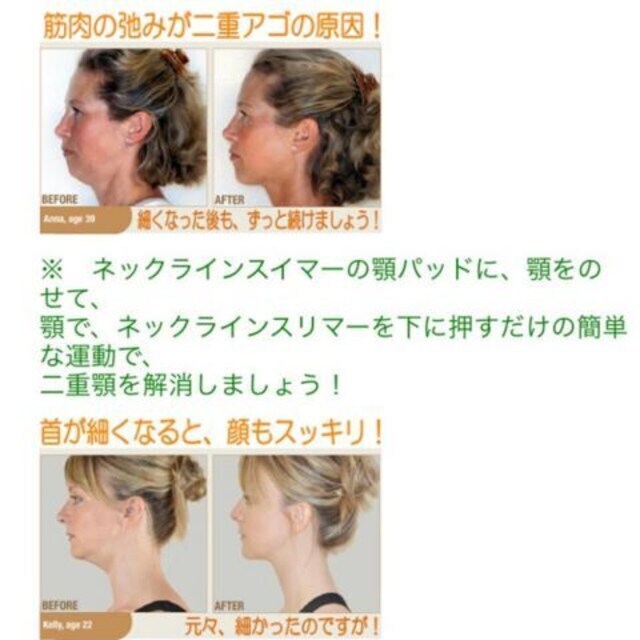 美顔 ネックスリマー 首 二重あご 小顔 リフトアップ 美容 シェイプアップ ダイエット ヘルス ビューティー 新品 中古のオークション モバオク No 美顔 ネックスリマー 首 二重あご 小顔 リフトアップ 美容 シェイプアップ ダイエット ヘルス ビューティー 新品 中古のオークション モバオク No